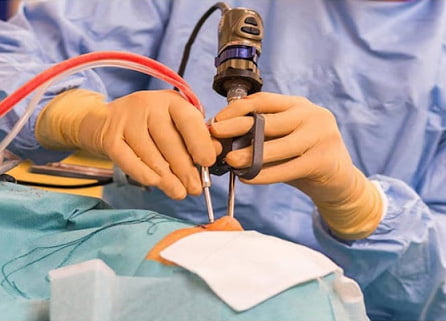جراحی آندوسکوپی سینوس در رشت - دکتر نگین نجمی
