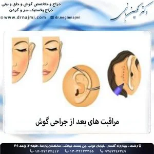 مراقبت های بعد از جراحی گوش