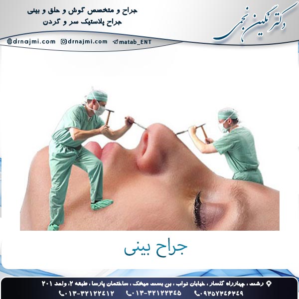 جراح بینی در تهران - دکتر نجمی
