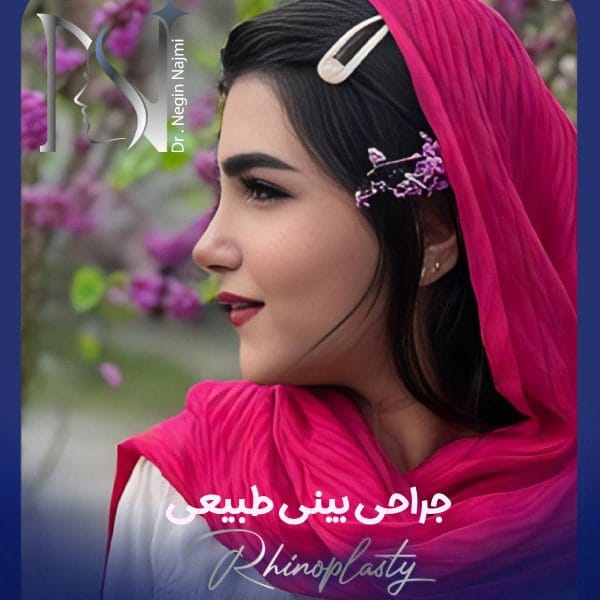 جراحی بینی طبیعی - دکتر نگین نجمی 