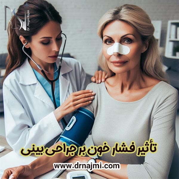 تأثیر فشار خون بر جراحی بینی - دکتر نگین نجمی
https://drnajmi.com/