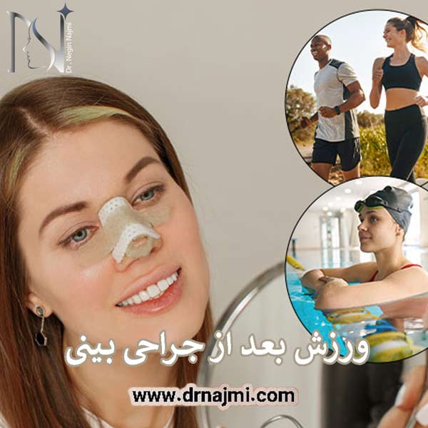 ورزش بعد از جراحی بینی