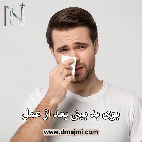 بوی بد بینی بعد از عمل