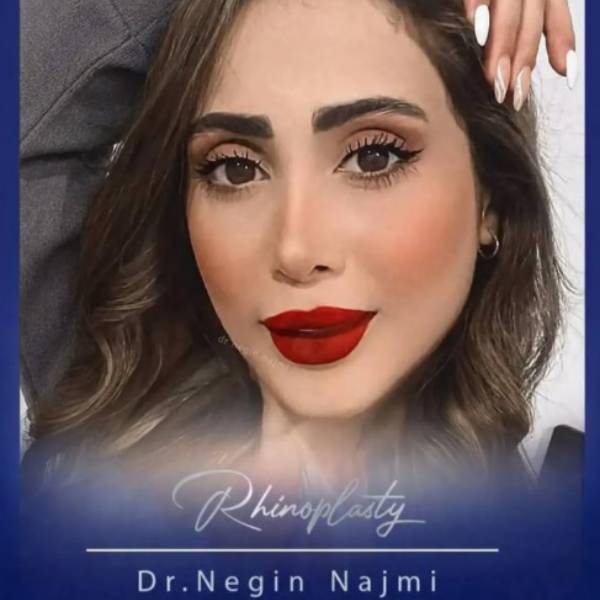 جراحی بینی طبیعی