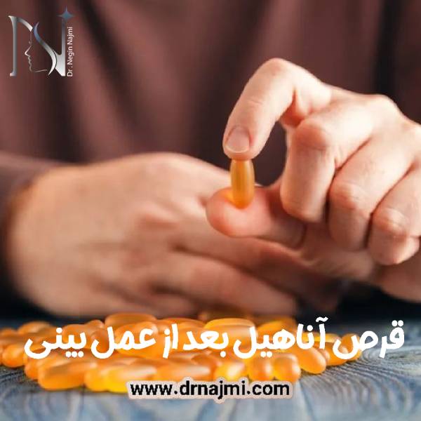 قرص آناهیل بعد از عمل بینی