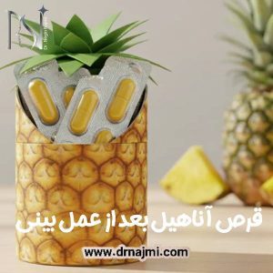 قرص آناهیل بعد از عمل بینی