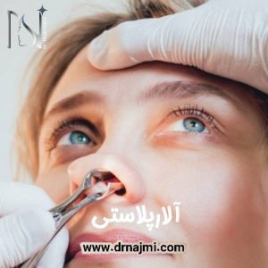 آلارپلاستی | کوچک کردن پره های بینی
