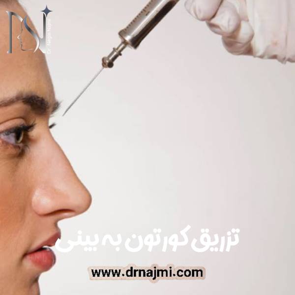 تزریق کورتون به بینی