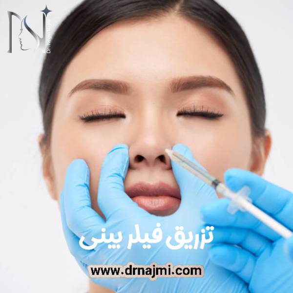 تزریق فیلر بینی