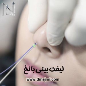 لیفت بینی با نخ