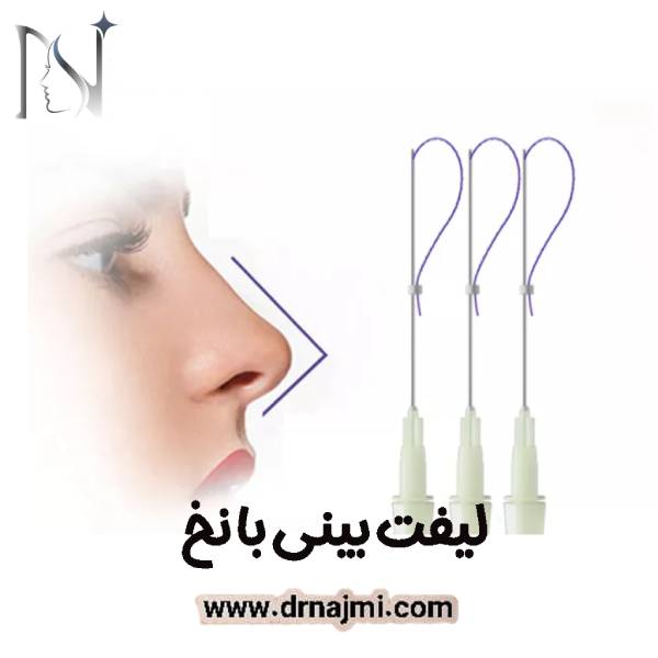 لیفت بینی با نخ