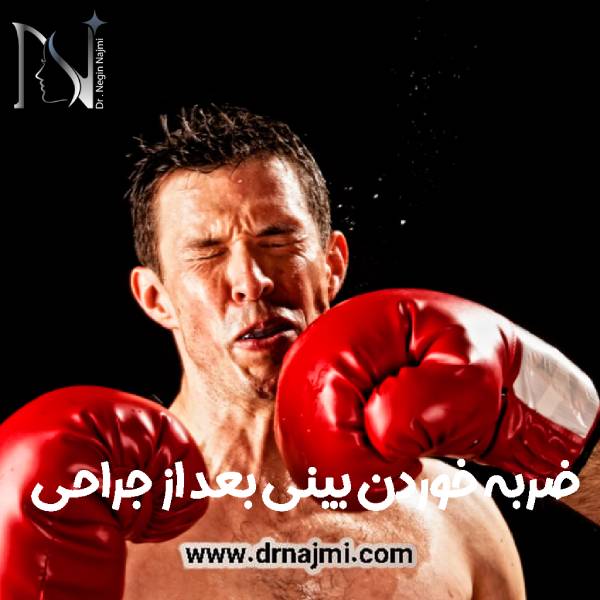 ضربه خوردن بینی جراحی شده