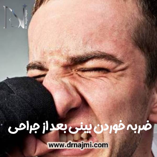 ضربه خوردن بینی جراحی شده