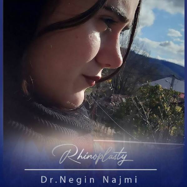 جراحی زیبایی بینی