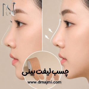 چسب لیفت بینی