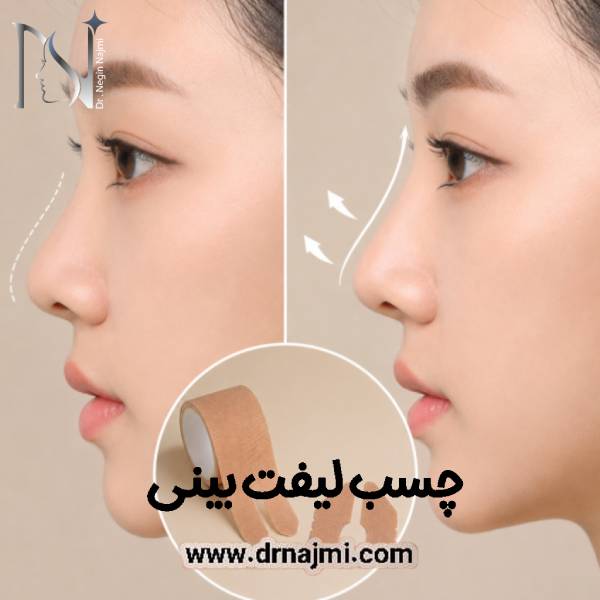 چسب لیفت بینی