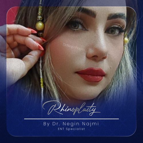 جراحی-بینی-125