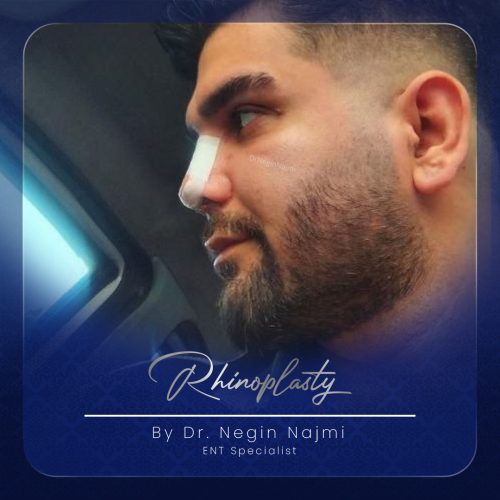 جراحی-بینی-126
