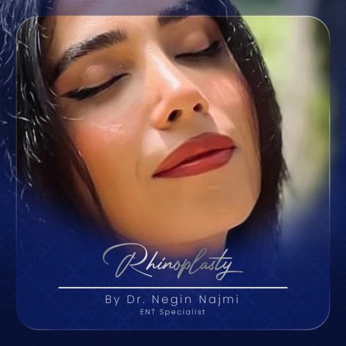 جراحی-بینی-130