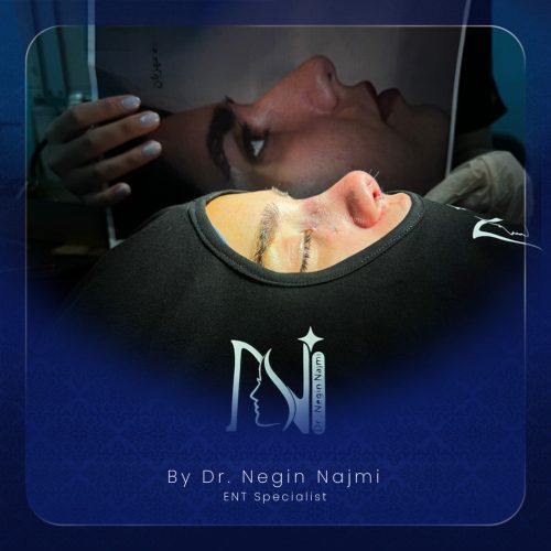 جراحی-بینی-131