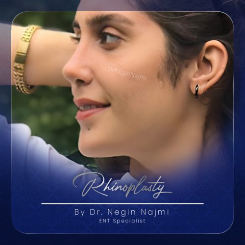 جراحی-بینی-132