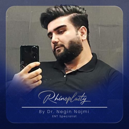 جراحی-بینی-137