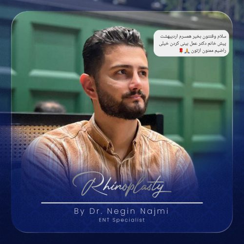 جراحی-بینی-138