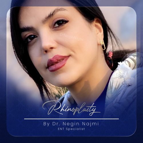 جراحی-بینی-139