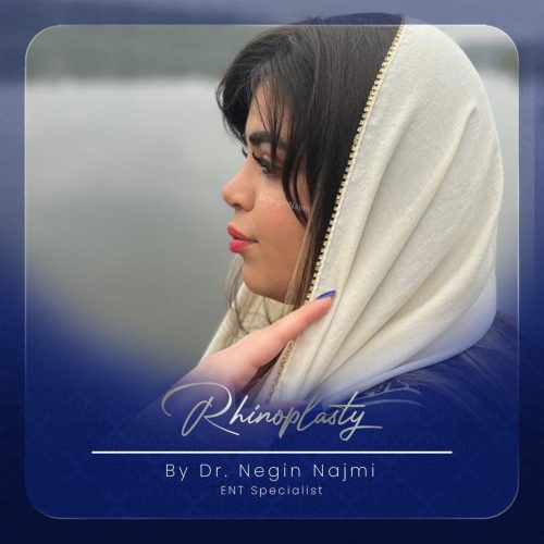 جراحی-بینی-141