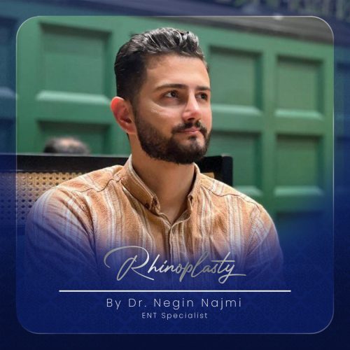 جراحی-بینی-142