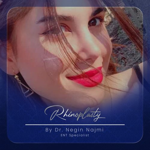 جراحی-بینی-144