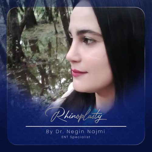 جراحی-بینی-145