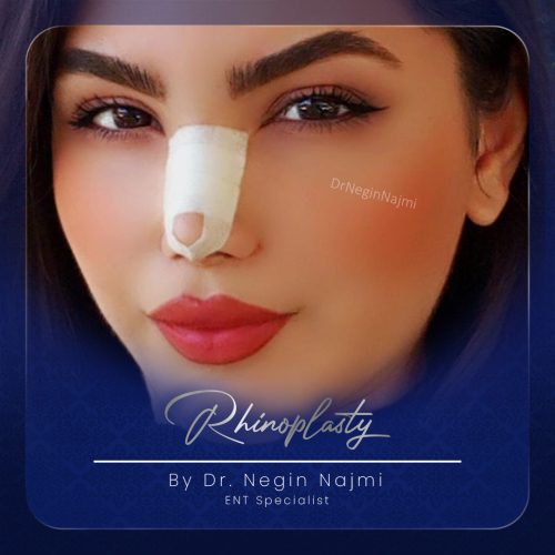 جراحی-بینی-146