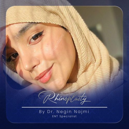 جراحی-بینی-147