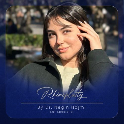 جراحی-بینی-149