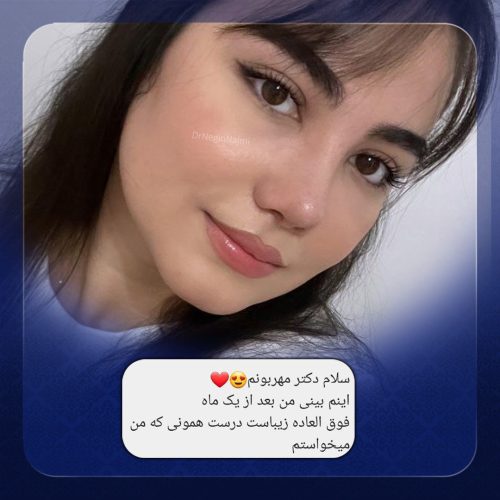 جراحی-بینی-150