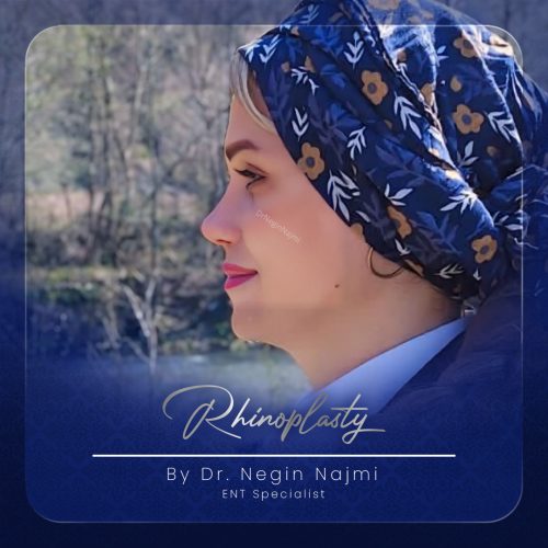 جراحی-بینی-153