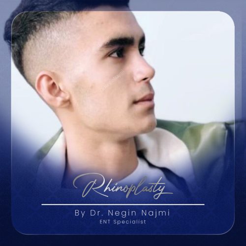 جراحی-بینی-155