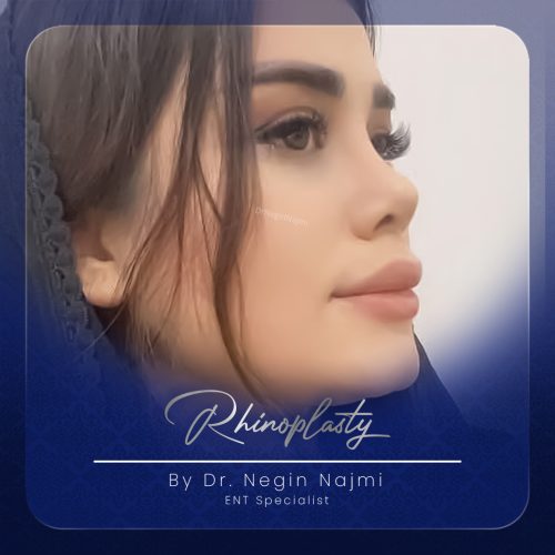 جراحی-بینی-158
