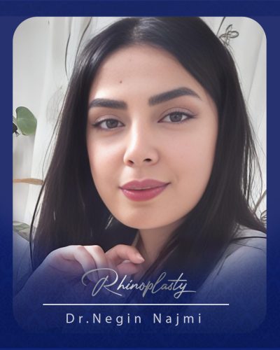 جراحی-بینی-162