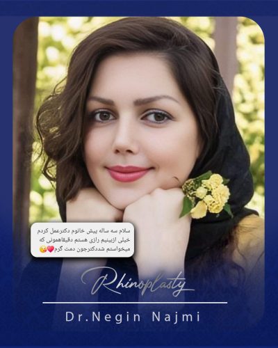 جراحی-بینی-163