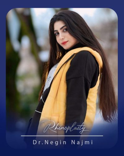 جراحی-بینی-167