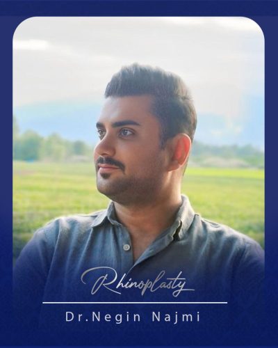 جراحی-بینی-171