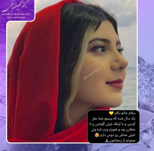 جراحی-بینی-66